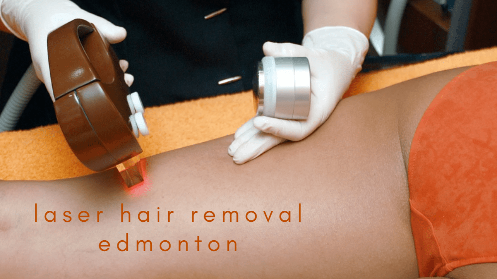 Best Laser Hair Removal in Edmonton